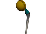Artificial Hip 3D Model preview