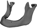 Edentulous Jaw 3D Model preview