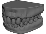 Teeth and Gums 3D Model preview